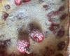 Clafoutis aux cerises facile et moelleux