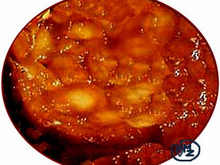 Tarte tatin pommes et mangues