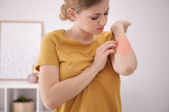 Eczéma : quels sont les aliments à privilégier pour lutter contre ce problème de peau ?