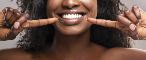 Ces aliments qui jaunissent nos dents