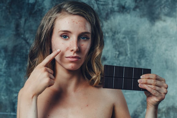 Acné : quels aliments éviter pour ne pas avoir de boutons ?