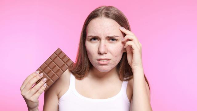 Le chocolat donne-t-il vraiment des boutons ?