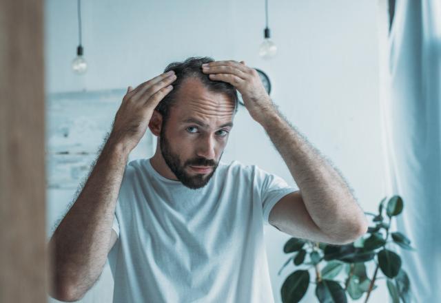 Une étude révèle l’une des causes de la calvitie et ça ne va pas vous plaire !