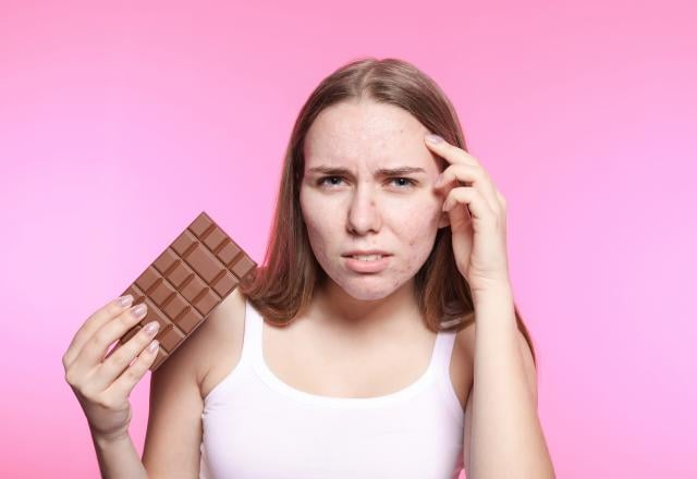 Le chocolat donne-t-il vraiment des boutons ?