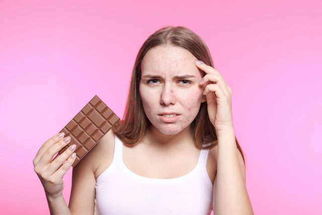 Le chocolat donne-t-il vraiment des boutons ?